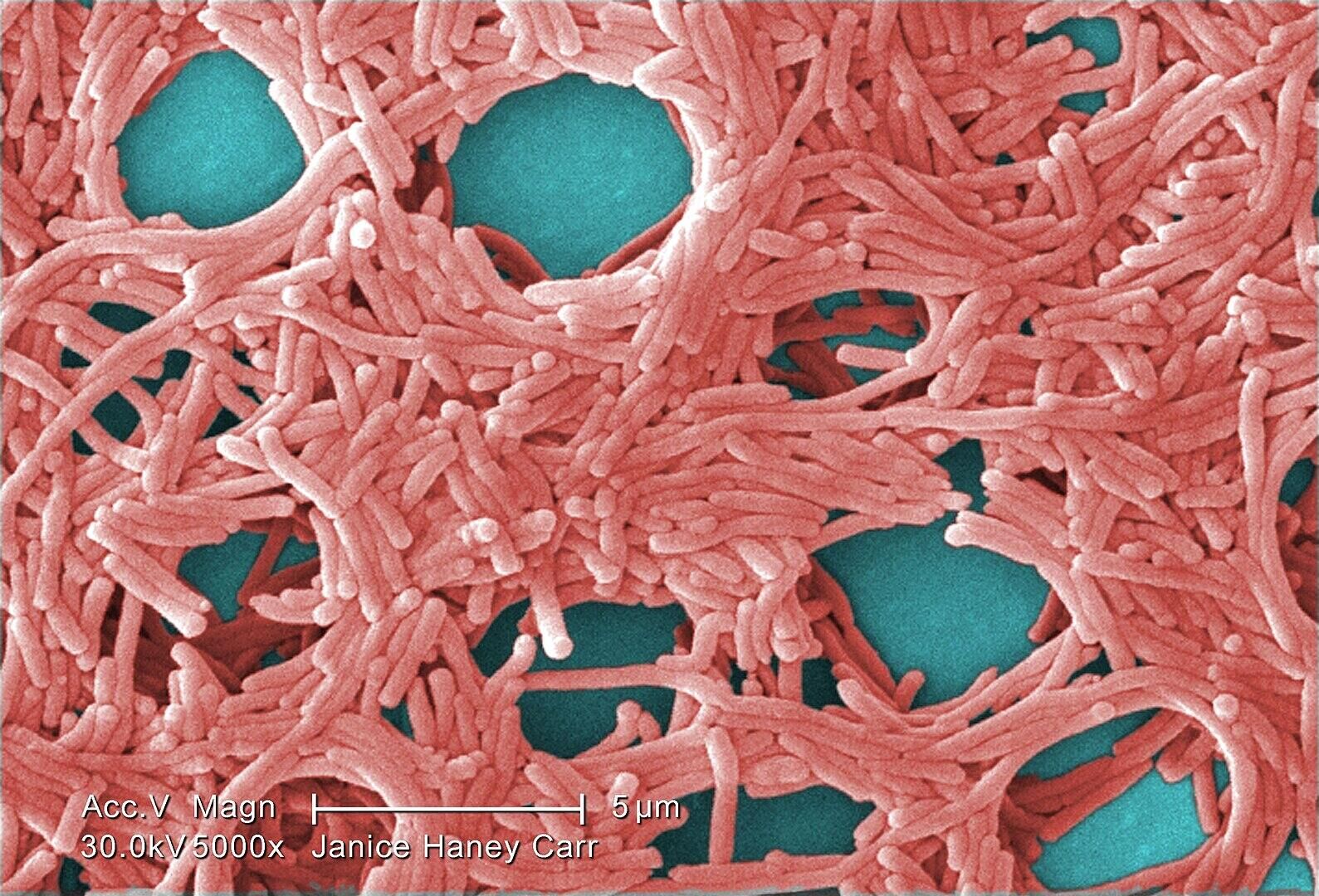 Legionella pneumophila на электросканограмме - РИА Новости, 1920, 19.10.2023