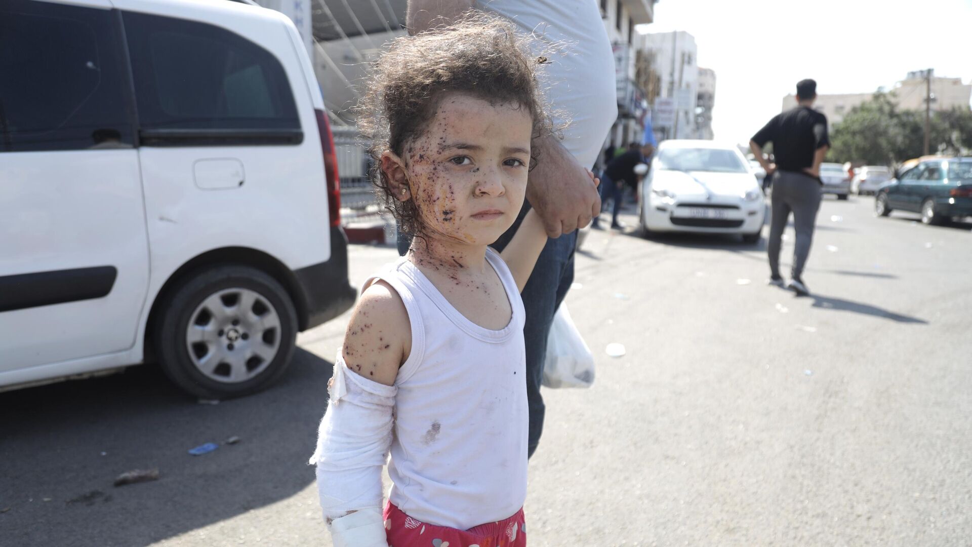 Ребенок, пострадавший в результате ракетных ударов ВС Израиля по Газе - РИА Новости, 1920, 13.12.2023