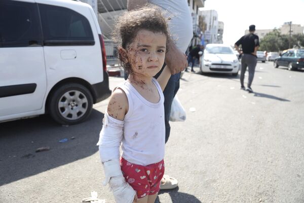 Ребенок, пострадавший в результате ракетных ударов ВС Израиля по Газе