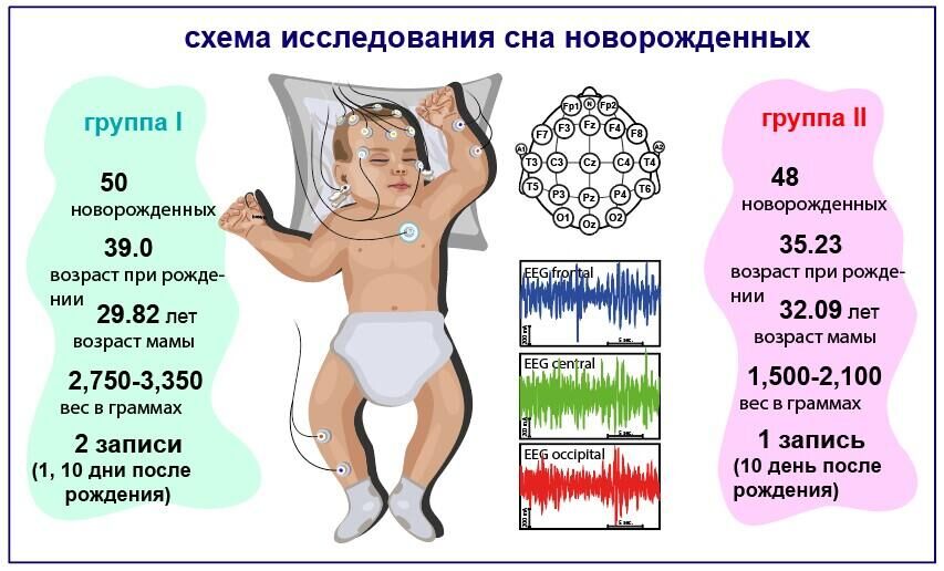 Схема исследования сна новорожденных - РИА Новости, 1920, 28.11.2023