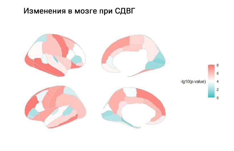 Изменения в мозге при СДВГ - РИА Новости, 1920, 05.12.2023