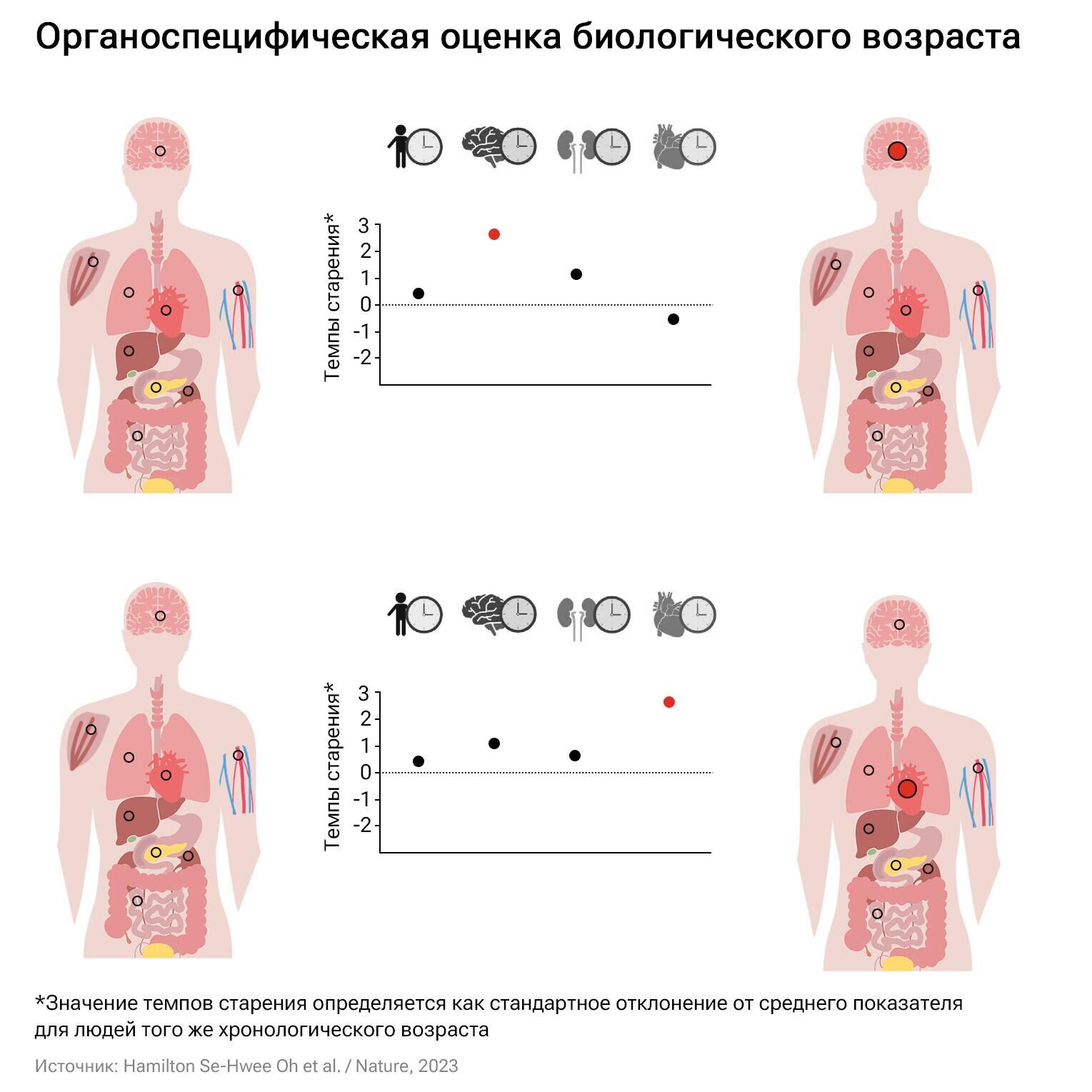 Определение по маркерным белкам возраста отдельных органов позволяет точнее оценить индивидуальные темпы старения человека и определить слабое звено организма, с которым связаны риски развития заболеваний и смерти в будущем - РИА Новости, 1920, 21.12.2023