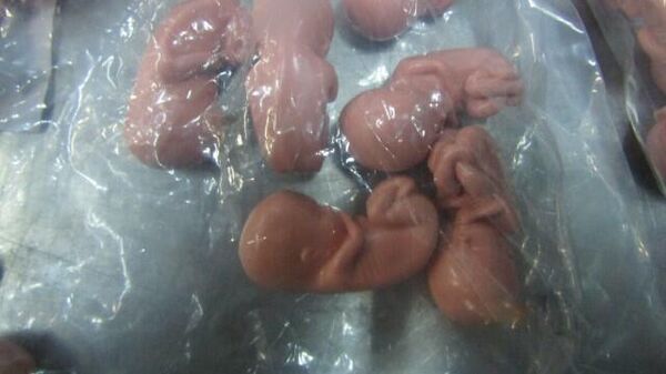 Модели эмбриона человека, обнаруженные таможенниками  в пункте пропуска Ивангород