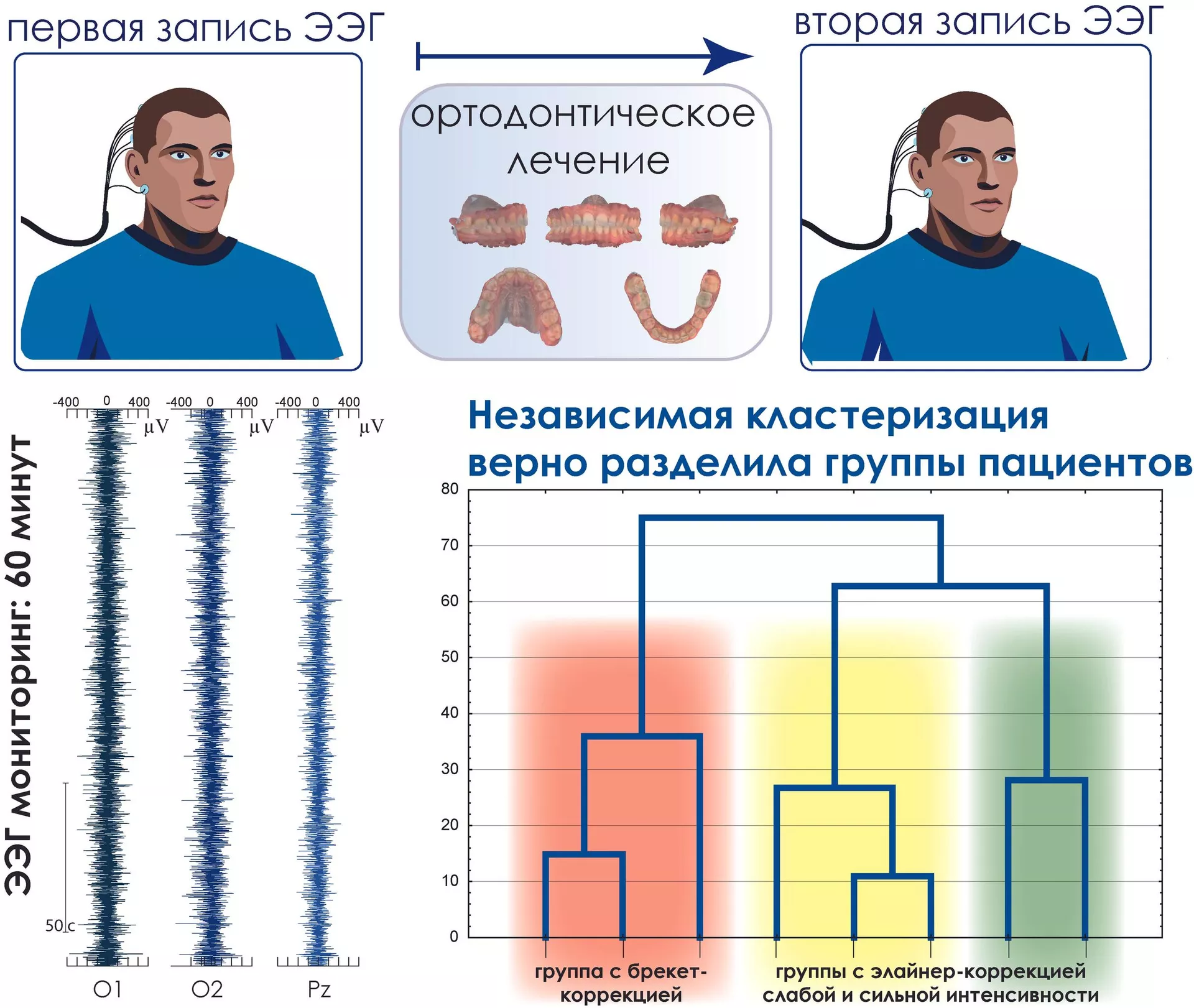 Схема проведения клинического исследования и результатов цифрового исследования активности головного мозга пациентов с ортодонтическим лечением Схема проведения клинического исследования и результатов цифрового исследования активности головного мозга пациентов с ортодонтическим лечением - РИА Новости, 1920, 04.03.2024