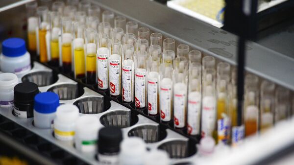Лаборатория иммуноферментных исследований, где проходит исследование крови на инфекции - гепатит, сифилис, ВИЧ 