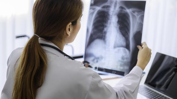 Врач осматривает рентгеновский снимок грудной клетки пациента в больнице