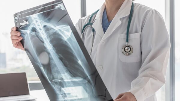 Врач изучает рентгеновский снимок грудной клетки пациента  