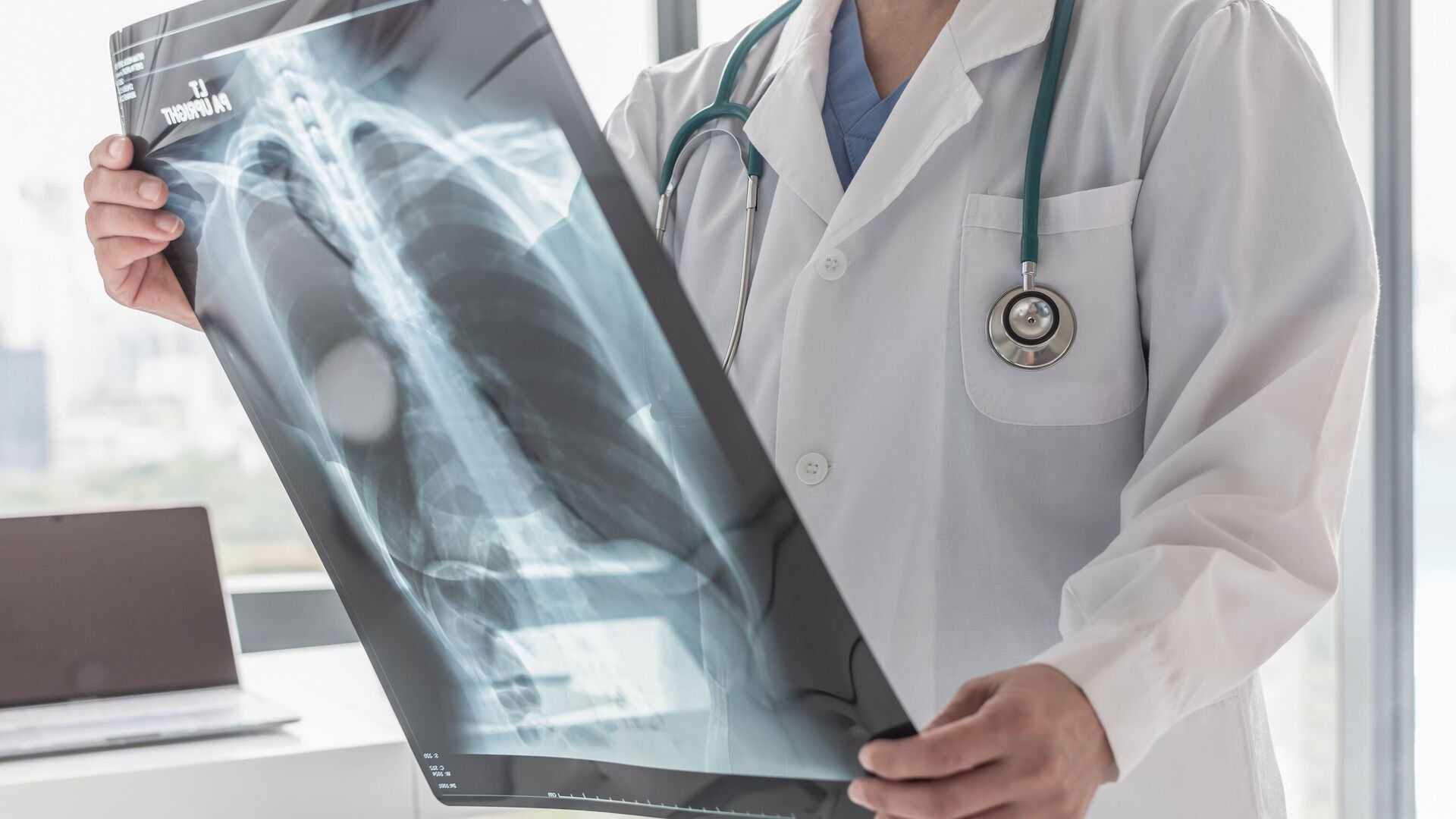 Врач изучает рентгеновский снимок грудной клетки пациента   - РИА Новости, 1920, 26.03.2024