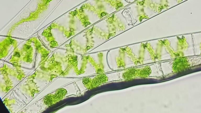 Микроводоросли рода Porphyridium под микроскопом