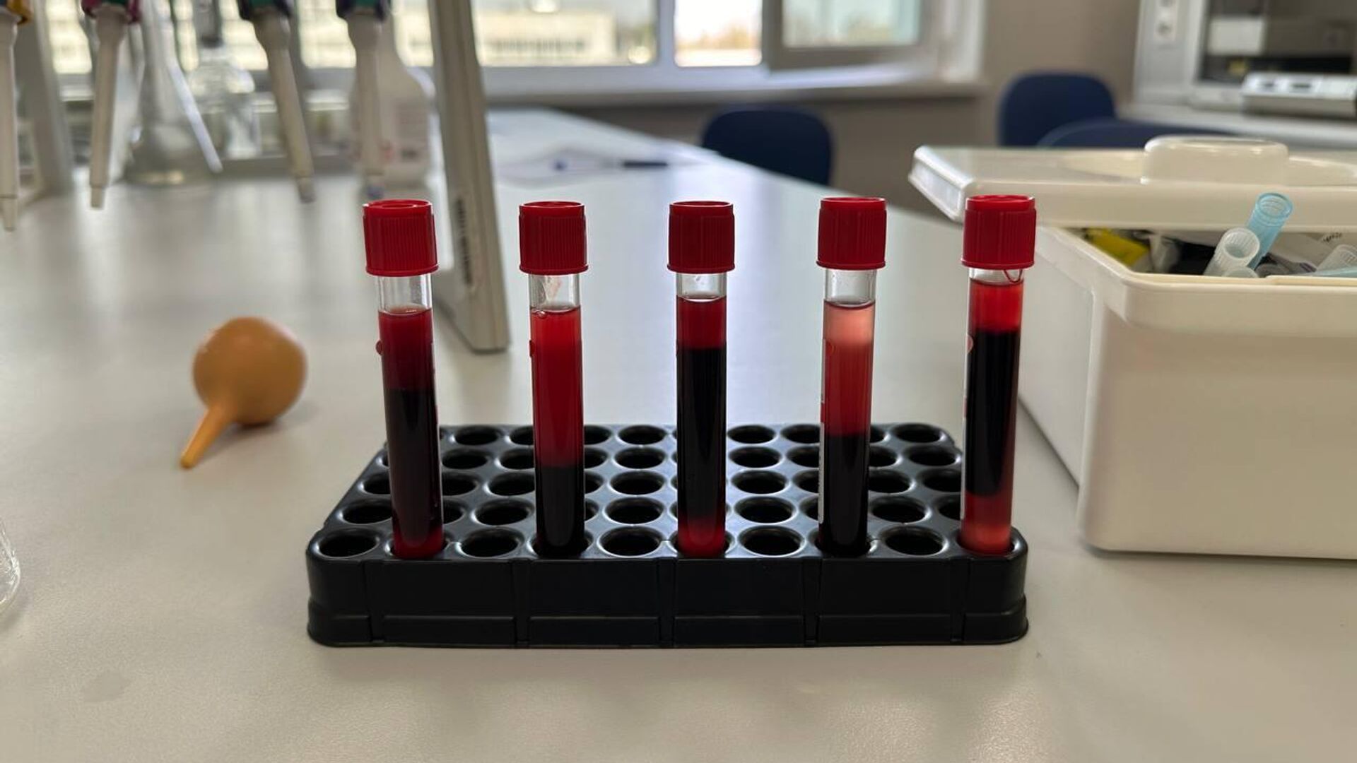 В России предложили состав для безопасной консервации крови - РИА Новости,  20.06.2024