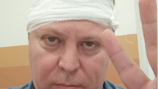 Депутат Госдумы Михаил Матвеев после нападения в Самаре