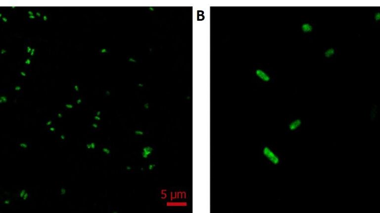 Изображение кишечной палочки (бактерии Escherichia coli) в разных масштабах, полученное с помощью флуоресцентного микроскопа Алексеем Матухно и Ариной Понятовской в НИТЦ нейротехнологий ЮФУ Изображение кишечной палочки (бактерии Escherichia coli) в разных масштабах, полученное с помощью флуоресцентного микроскопа Алексеем Матухно и Ариной Понятовской в НИТЦ нейротехнологий ЮФУ