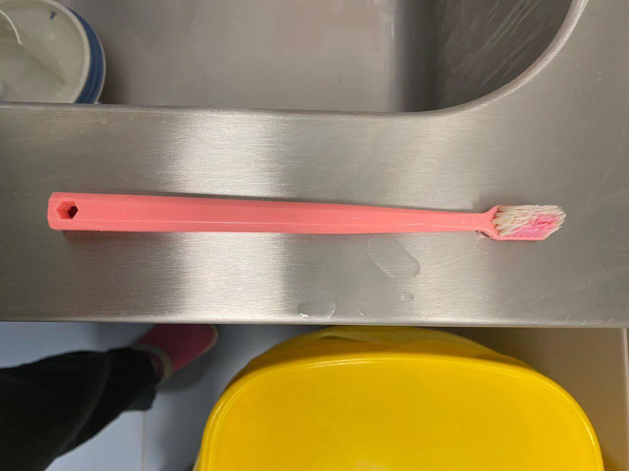 Зубная щетка, извлеченная из желудка 16-летней девушки врачами подмосковного Детского клинического центра имени Л. М. Рошаля - РИА Новости, 1920, 23.01.2025