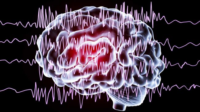 Мозговые волны при эпилепсии