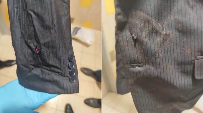 Министр обороны республики Роберт Калиняк продемонстрировал фотографии одежды со следами от пуль и запекшейся кровью из больницы после нападения на главу правительства Словакии Роберта Фицо