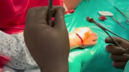 Врачи оперируют туристку из Москвы, на которую во время снорклинга напала акула - РИА Новости, 1920, 17.04.2025