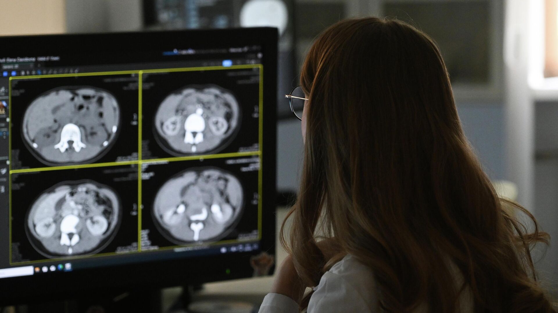 Врач-рентгенолог в кабинете Врач-рентгенолог в кабинете - РИА Новости, 1920, 04.06.2025