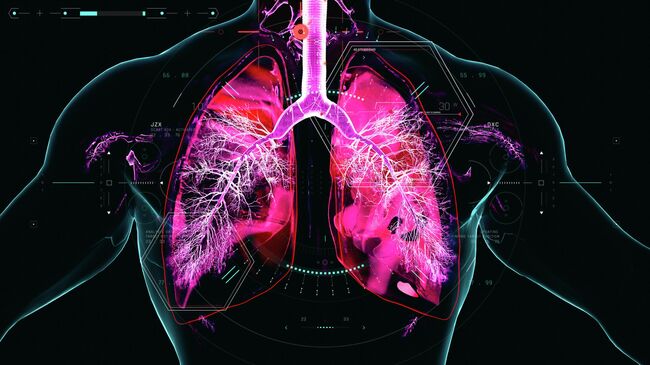 Хроническая болезнь легких  Хроническая болезнь легких