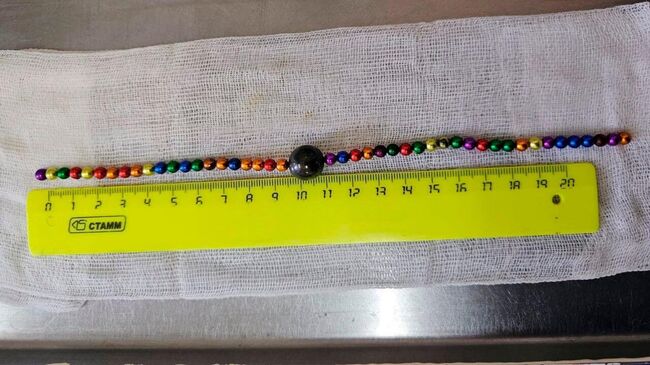 В Воронеже врачи извлекли 48 магнитов из желудка и кишечника двухлетнего ребенка В Воронеже врачи извлекли 48 магнитов из желудка и кишечника двухлетнего ребенка