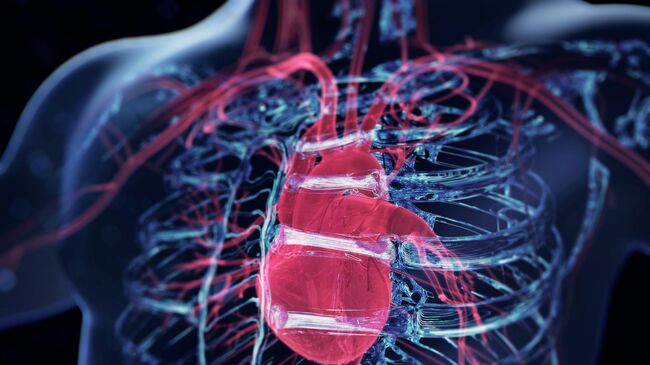 Инфаркт Инфаркт