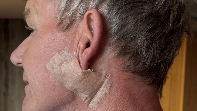 Шеф-повару Гордону Рамзи удалили опухоль