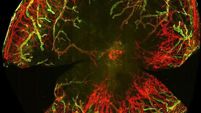 Микрофотография сосудов в роговице Микрофотография сосудов в роговице