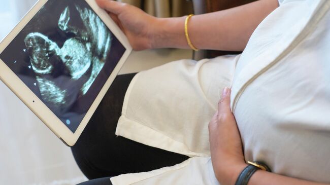 Беременная женщина со снимком УЗИ