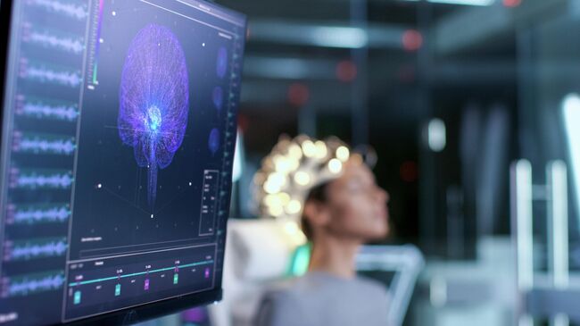 Сканирование мозга Сканирование мозга