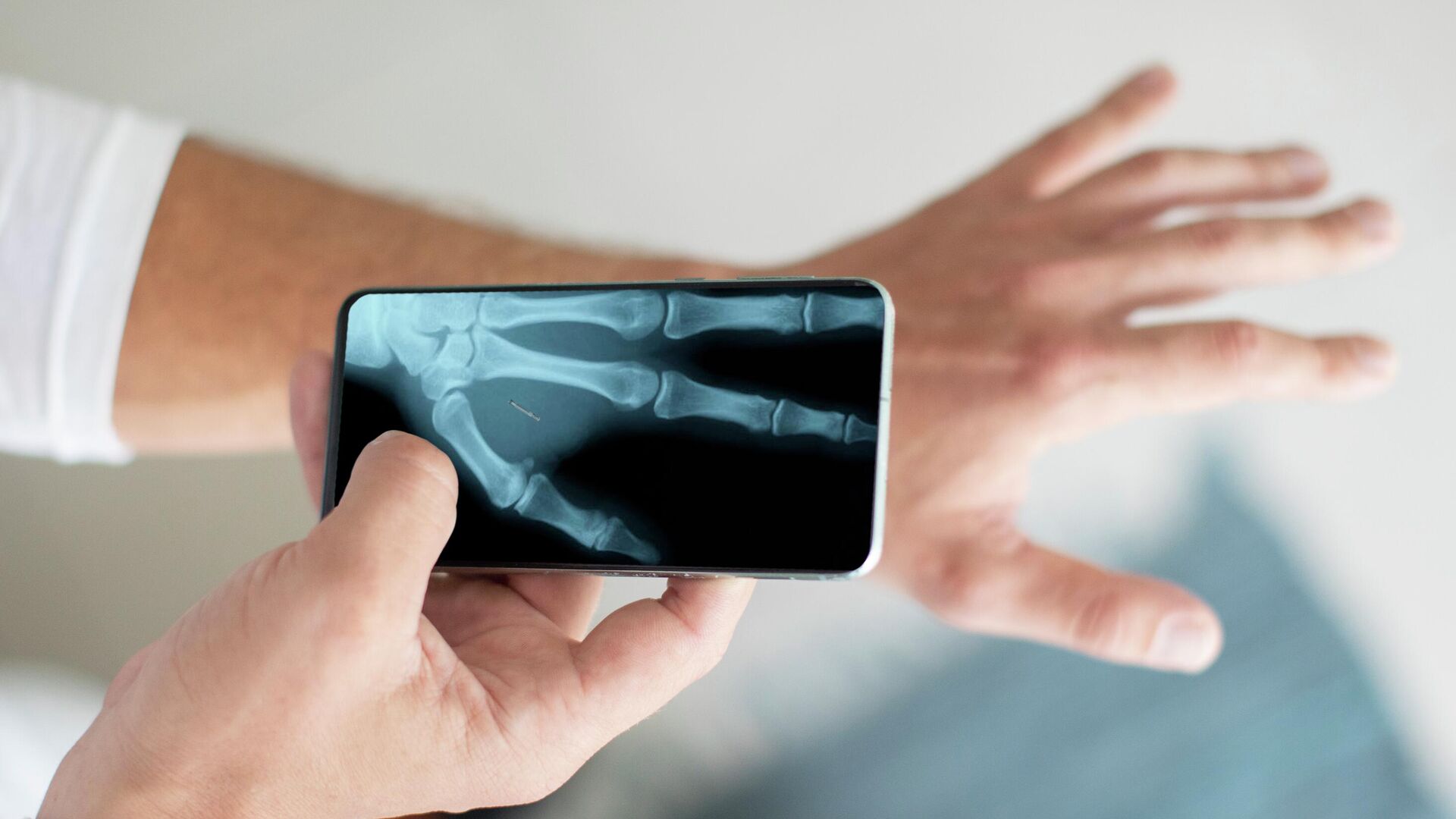 Рентгеновский снимок на телефоне - РИА Новости, 1920, 17.09.2025