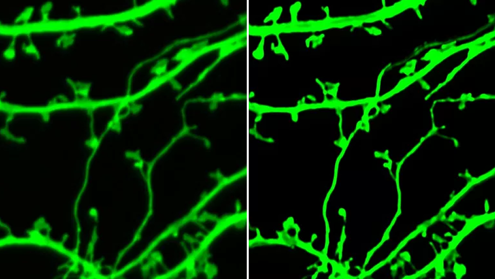 Изображение гиппокампального нейрона in vitro: до и после - РИА Новости, 1920, 14.10.2025