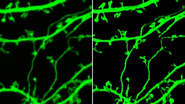 Изображение гиппокампального нейрона in vitro: до и после