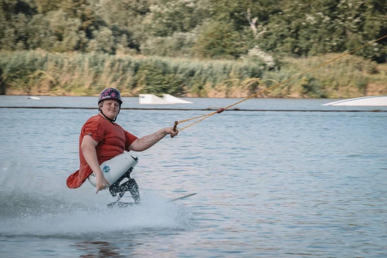 "Остался без обеих ног". К чему приводит опасное увлечение подростков