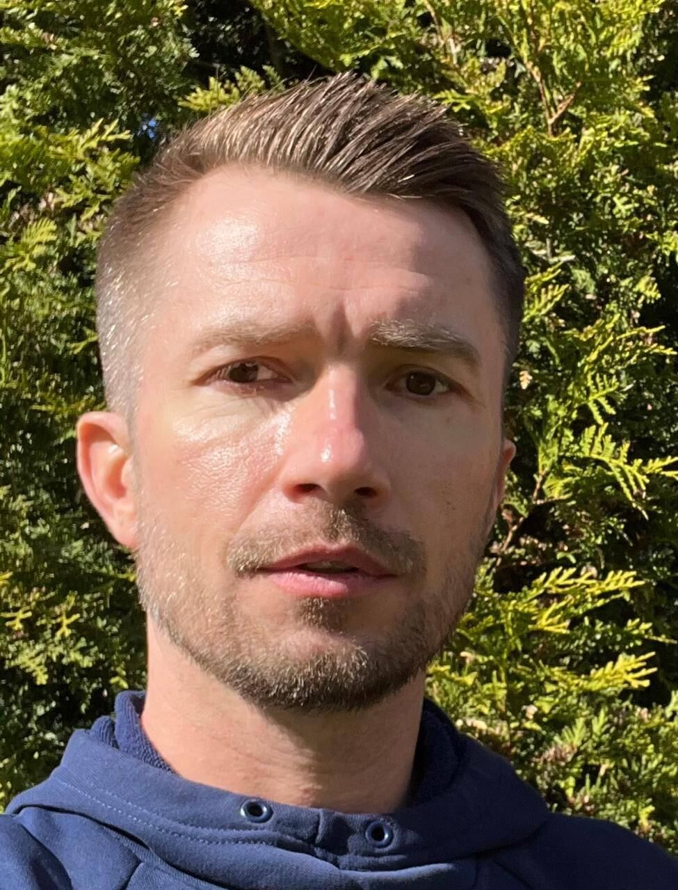 "Остался без обеих ног". К чему приводит опасное увлечение подростков