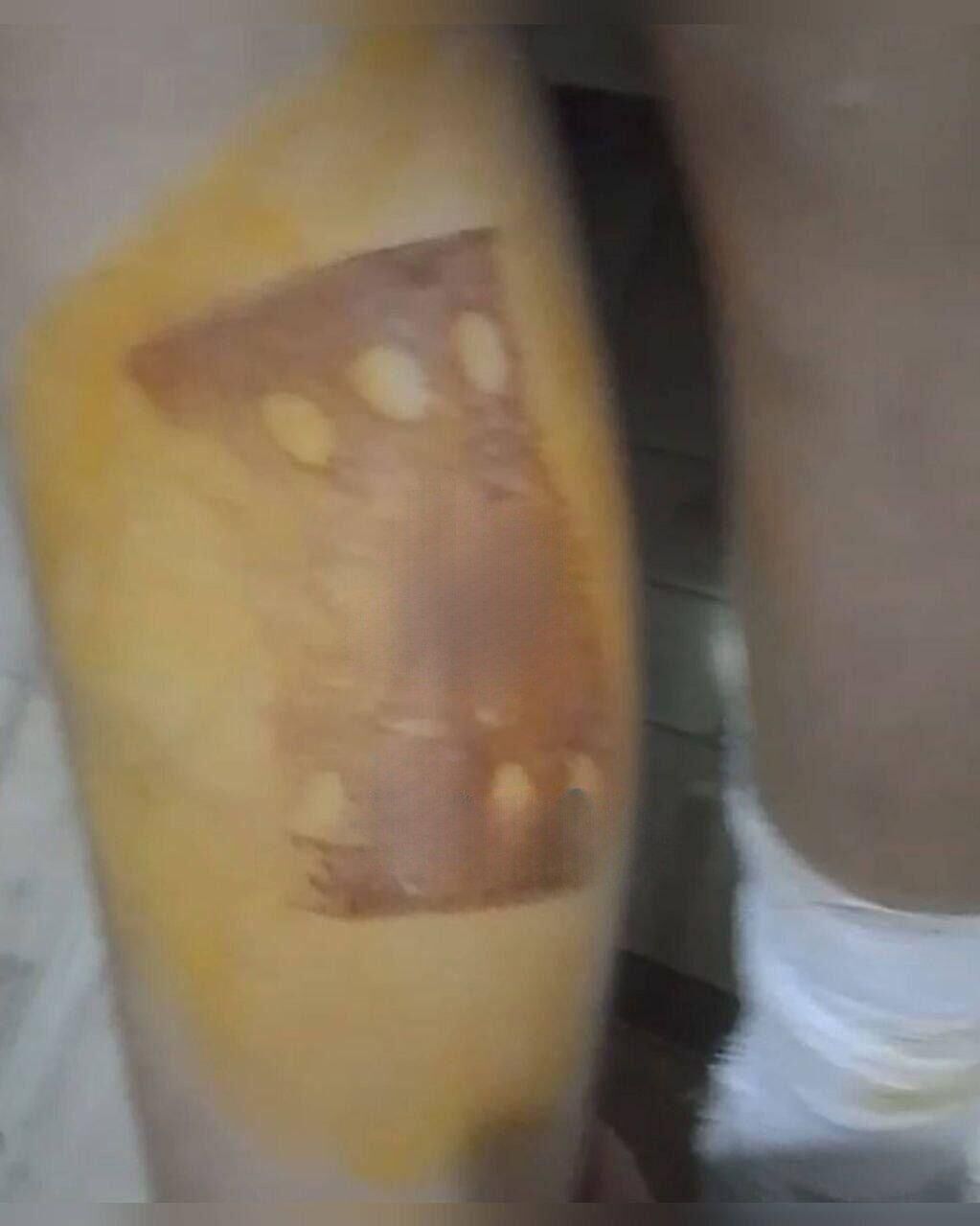 Следы ожогов от утюга - РИА Новости, 1920, 14.11.2025