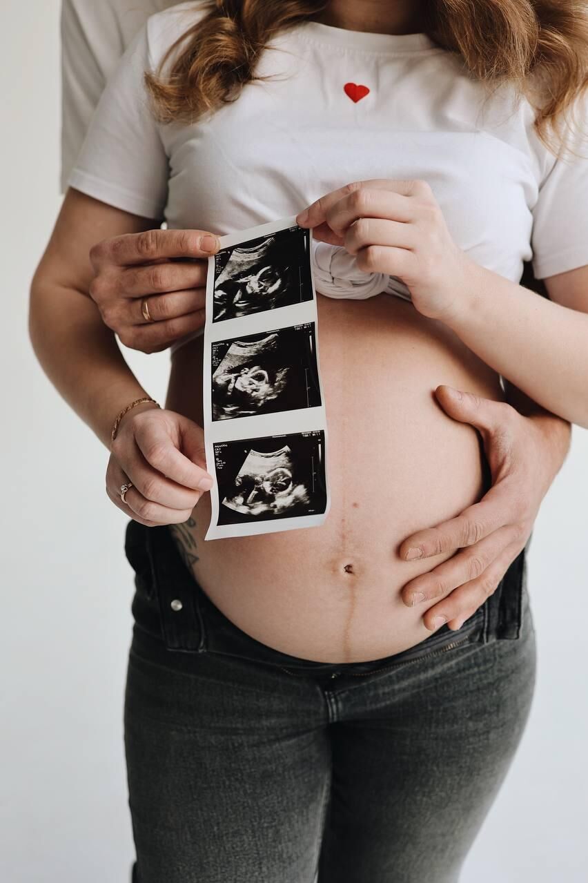 Анжелика Румянцева незадолго до родов - РИА Новости, 1920, 18.12.2025