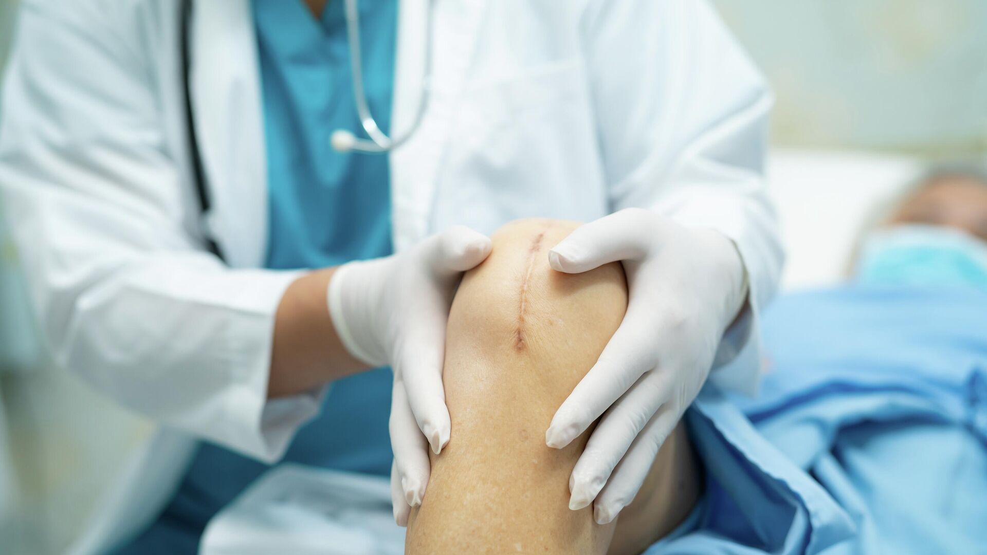 Врач осматривает пациента после операции по замене коленного сустава  - РИА Новости, 1920, 22.12.2025
