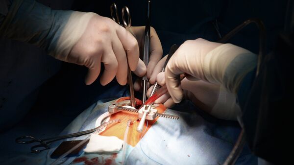 Врачи проводят операцию на открытом сердце. Архивное фото