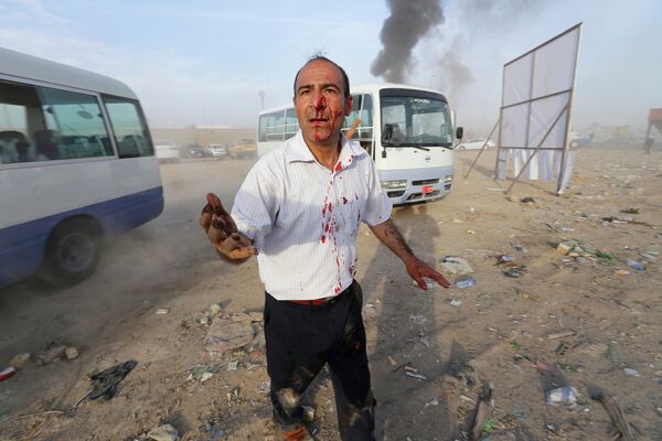 Пострадавший во время взрыва бомбы в Багдаде