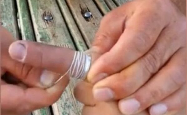 Властелин колец, или Как снять застрявшее кольцо нетрадиционным способом