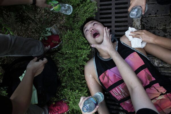 Раненый в результате столкновений полиции и протестующих в Гонконге