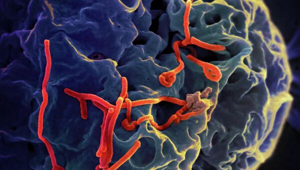 Вирус Эбола под микроскопом. Архивное фото