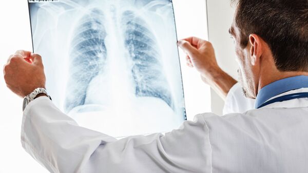 Врач проверяет рентген легких на пневмонию