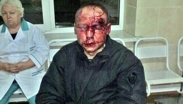 Учащийся ешивы Торат Хаим Шломо (Федор) Романовский после нападения на него в Московской области