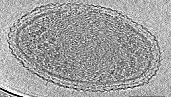 Фотография самой маленькой на сегодня бактерии, полученная при помощи электронного микроскопа