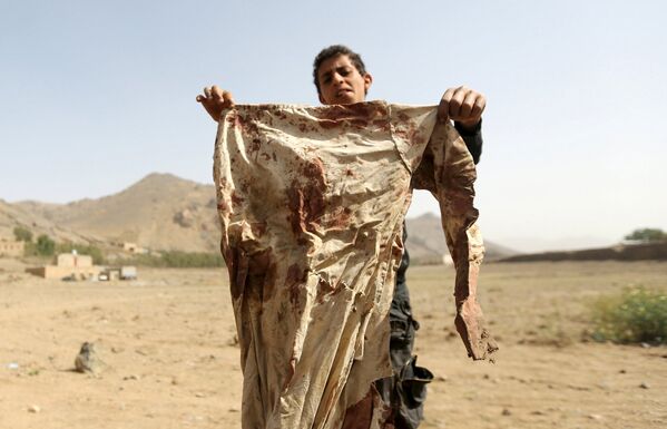 Мальчик держит окровавленные одежды, найденные после авиаудара к западу от столици Йемена. Апрель 2015