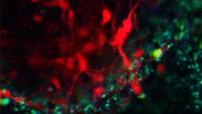 Микрофотография культуры гибнущих клеток мозга