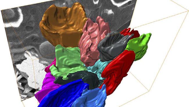 Трехмерное изображение эритроцитов, полученное при помощи FIB-микроскопа