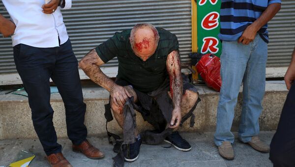 Мужчина, постадавший от взрыва в турецком городе Суруч