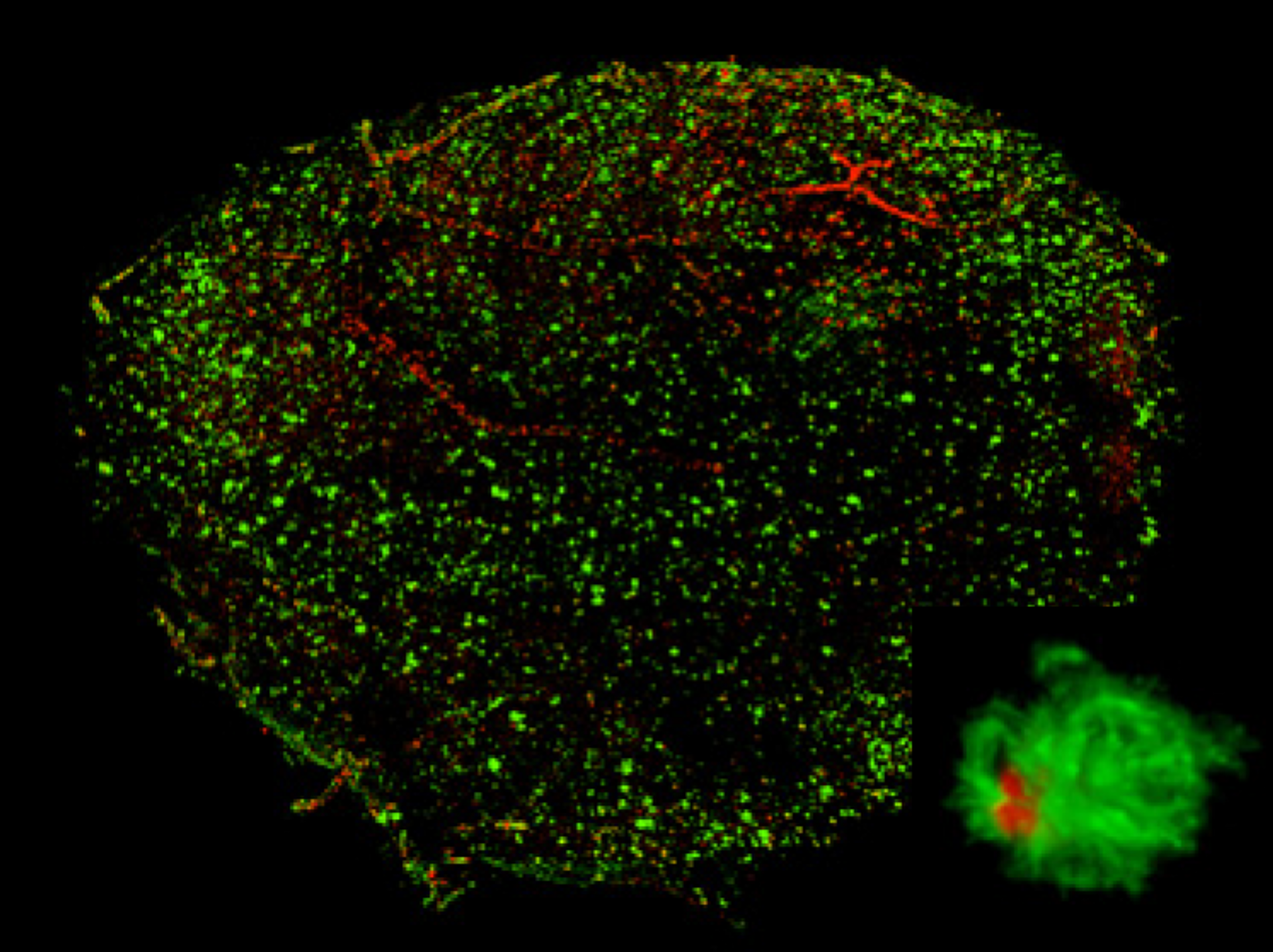 Бляшки бета-амилоида (показаны красным цветом), возникшие в мозге людей с болезнью Альцгеймера - РИА Новости, 1920, 26.02.2024