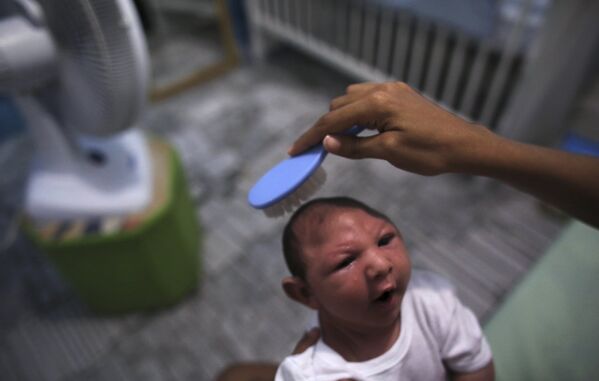 Ребенок, больной микроцефалией в городе Ресифе, Бразилия. 9 февраля 2016